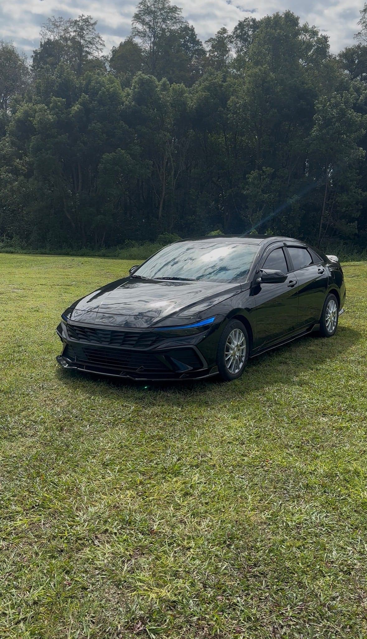 2024 Hyundai Elantra Sel Sport photo 3